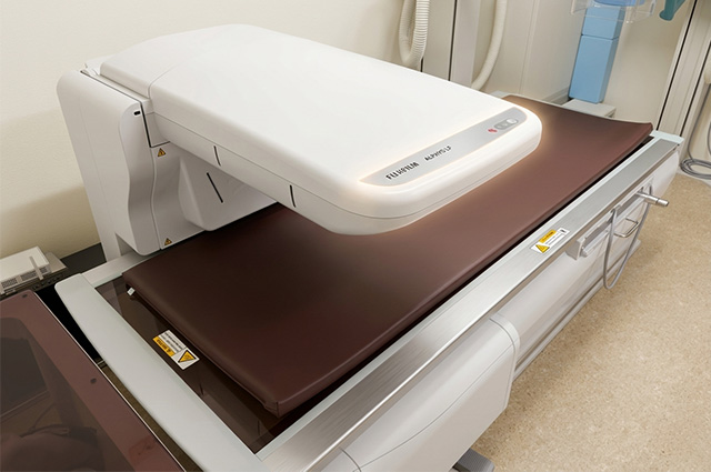 DEXA